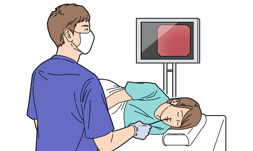 経鼻内視鏡検査